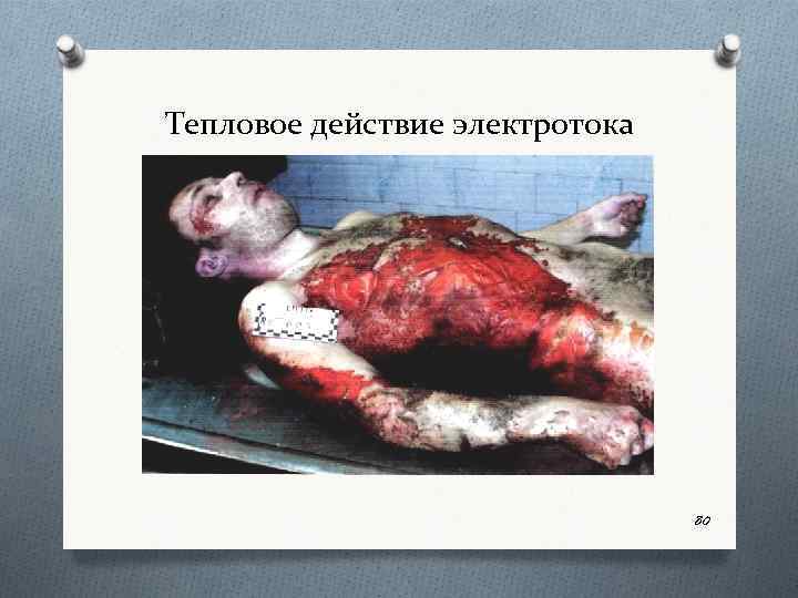 Тепловое действие электротока 80 