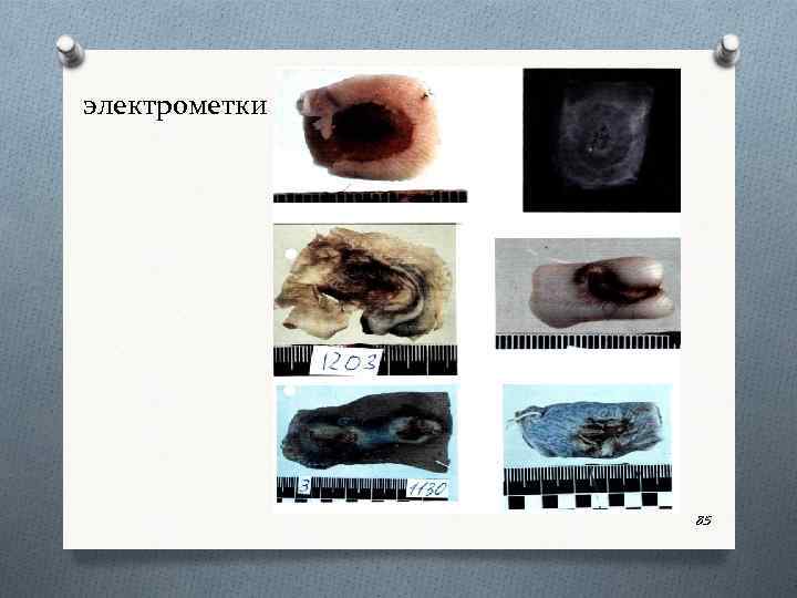 электрометки 85 