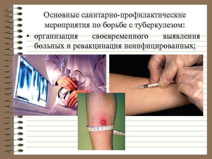  Основные санитарно-профилактические мероприятия по борьбе с    туберкулезом:  • организация