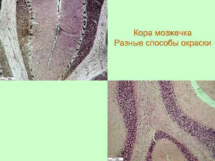 Кора мозжечка Разные способы окраски 