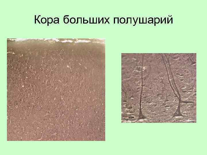 Кора больших полушарий 