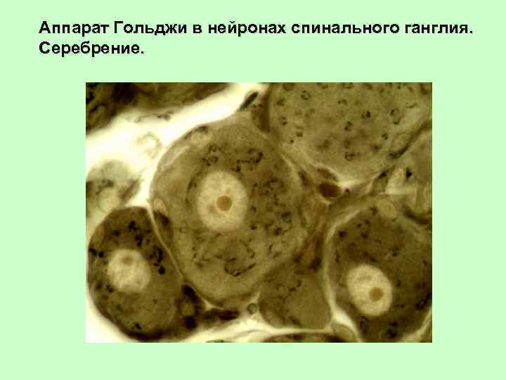 Аппарат Гольджи в нейронах спинального ганглия. Серебрение. 