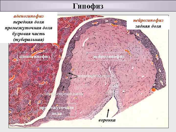 Мр картина диффузной неоднородности аденогипофиза