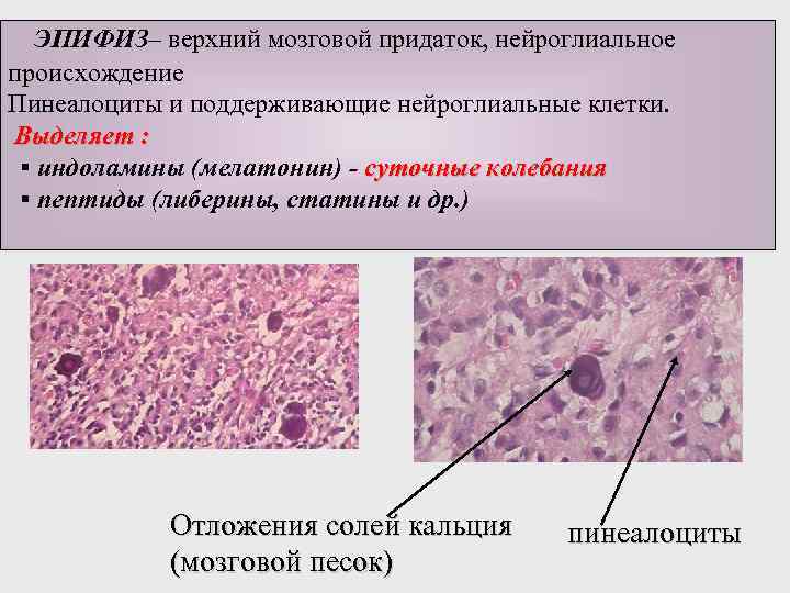 Эпифиз рисунок гистология