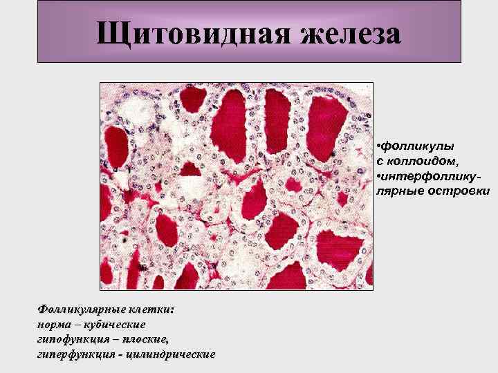 Щитовидная железа • фолликулы с коллоидом, • интерфолликулярные островки Фолликулярные клетки: норма – кубические