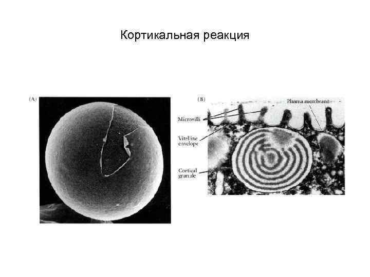 Кортикальная реакция 