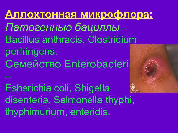 Аллохтонная микрофлора: Патогенные бациллы – Bacillus anthracis, Clostridium perfringens. Семейство Enterobacteriaceae – Esherichia coli,
