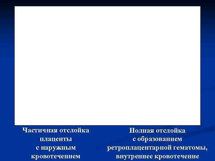 Частичная отслойка   Полная отслойка плаценты   с образованием с наружным 