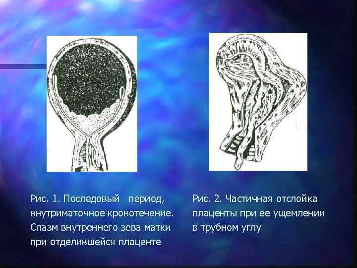 Зев матки