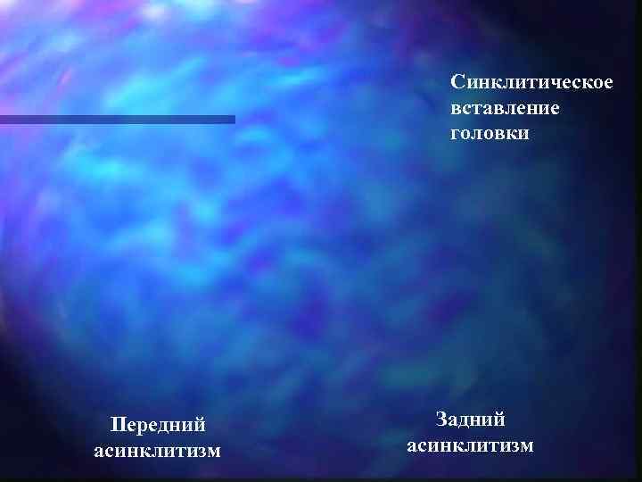    Синклитическое    вставление    головки  Передний