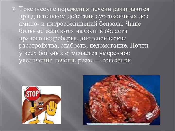   Токсические поражения печени развиваются при длительном действии субтоксичных доз амино и нитросоединений