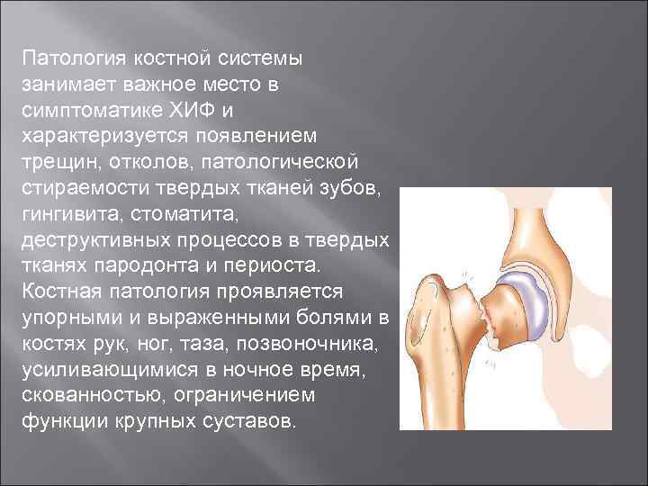 Патология костной системы занимает важное место в симптоматике ХИФ и характеризуется появлением трещин, отколов,