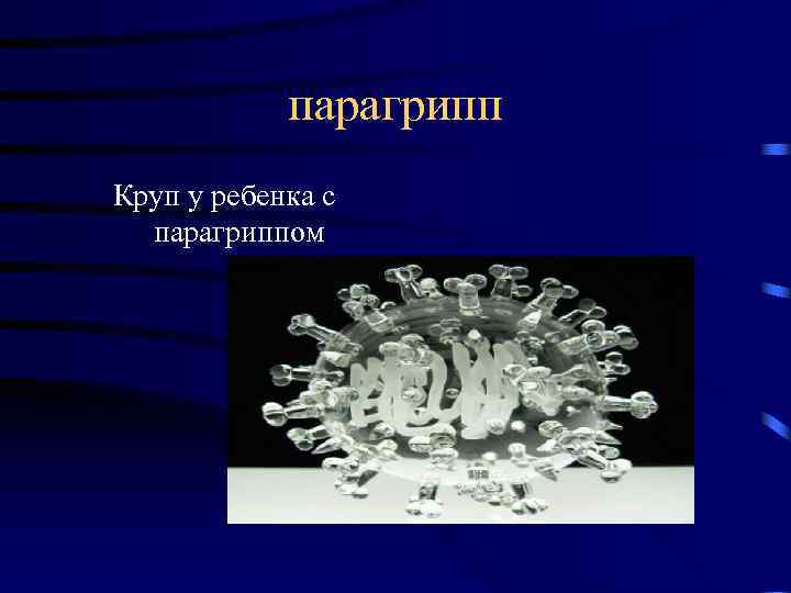   парагрипп Круп у ребенка с  парагриппом 
