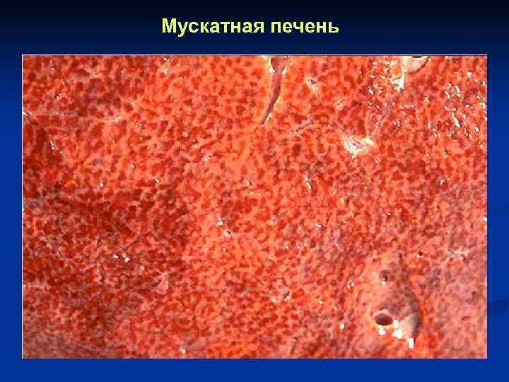 Мускатная печень 