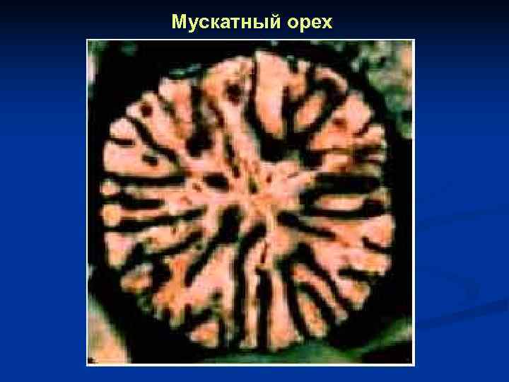 Мускатный орех 