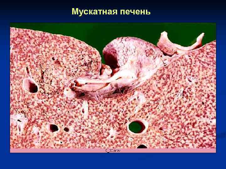 Мускатная печень 