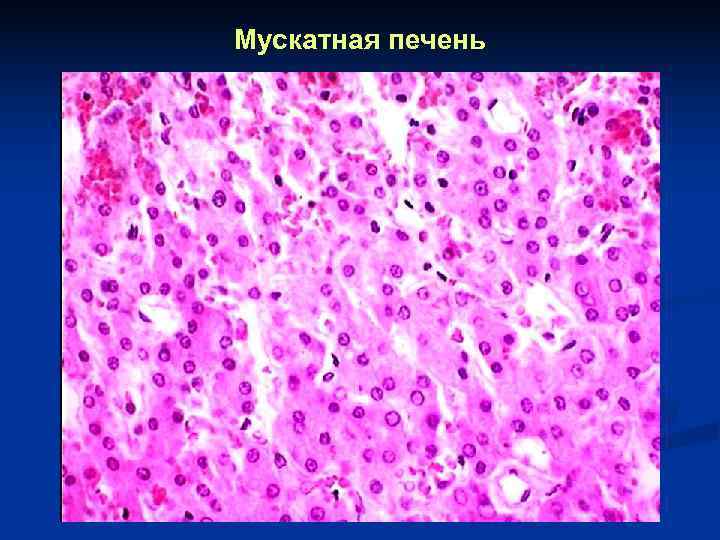 Мускатная печень 