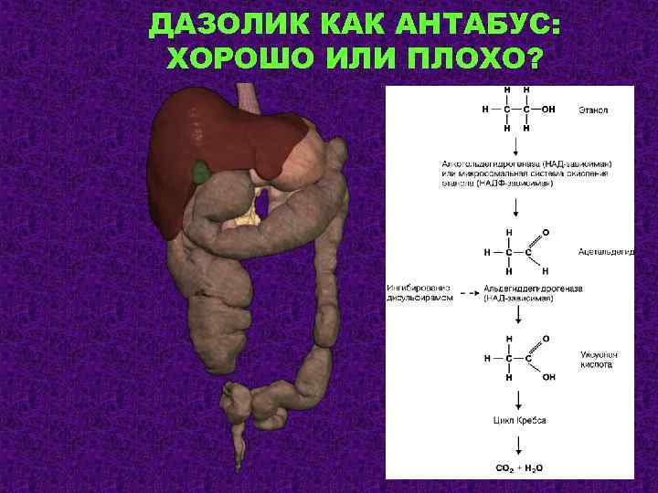 ДАЗОЛИК КАК АНТАБУС: ХОРОШО ИЛИ ПЛОХО? 