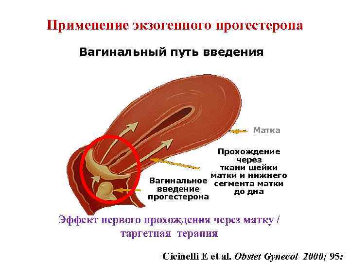 Применение экзогенного прогестерона Вагинальный путь введения Матка Прохождение через ткани шейки матки и нижнего