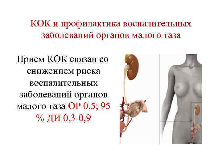 КОК и профилактика воспалительных заболеваний органов малого таза Прием КОК связан со снижением риска