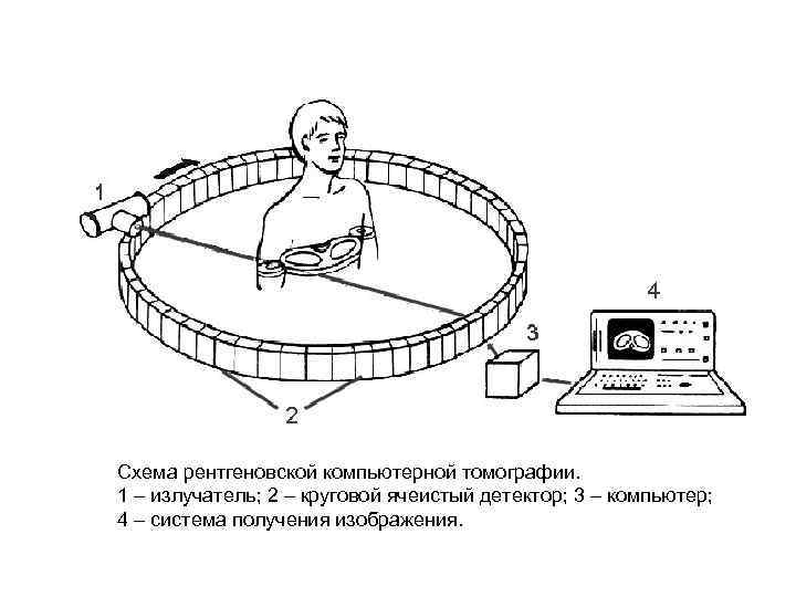 Схему получения изображения источник излучения вид излучения детектор