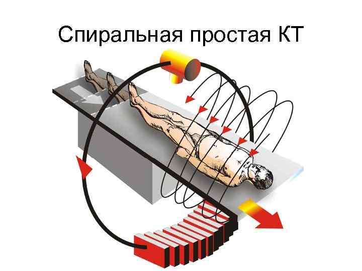 Спиральная простая КТ 