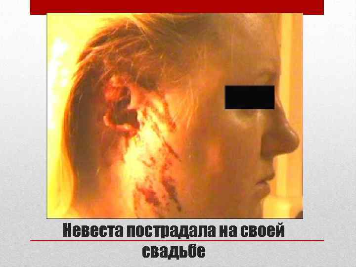 Невеста пострадала на своей  свадьбе 