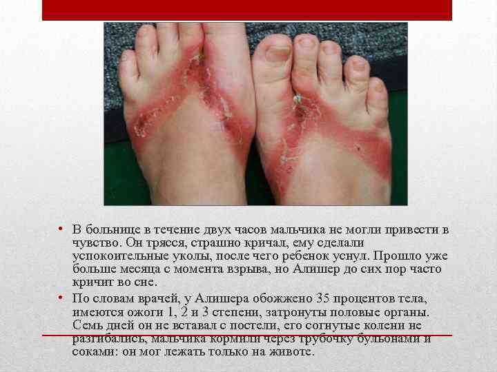  • В больнице в течение двух часов мальчика не могли привести в 