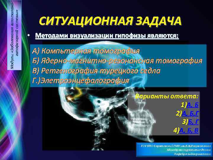 Модуль: «Заболевания гипоталамогипофизарной системы» СИТУАЦИОННАЯ ЗАДАЧА • Методами визуализации гипофизы являются: А) Компьтерная томография