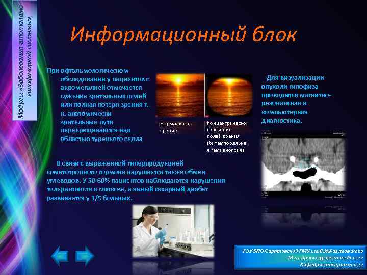 Модуль: «Заболевания гипоталамогипофизарной системы» Информационный блок При офтальмологическом обследовании у пациентов с акромегалией отмечается