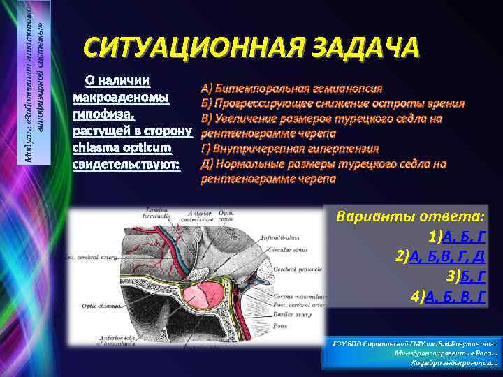 Модуль: «Заболевания гипоталамогипофизарной системы» СИТУАЦИОННАЯ ЗАДАЧА О наличии макроаденомы гипофиза, растущей в сторону chiasma