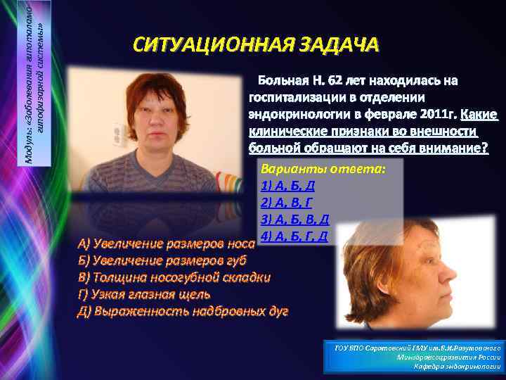Модуль: «Заболевания гипоталамогипофизарной системы» СИТУАЦИОННАЯ ЗАДАЧА Больная Н. 62 лет находилась на госпитализации в