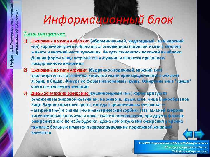 Модуль: «Заболевания гипоталамогипофизарной системы» Информационный блок Типы ожирения: 1) Ожирение по типу «яблока» (абдоминальный,