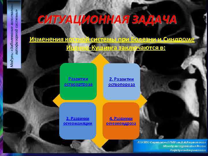 Модуль: «Заболевания гипоталамогипофизарной системы» СИТУАЦИОННАЯ ЗАДАЧА Изменения костной системы при Болезни и Синдроме Иценко
