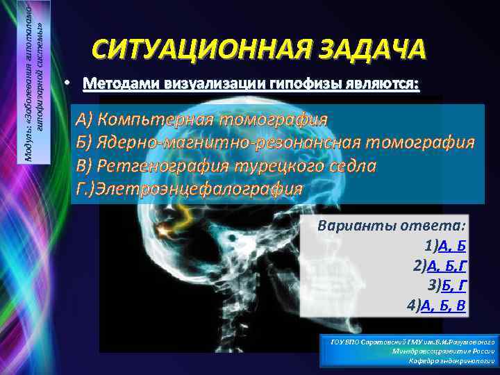 Модуль: «Заболевания гипоталамогипофизарной системы» СИТУАЦИОННАЯ ЗАДАЧА • Методами визуализации гипофизы являются: А) Компьтерная томография