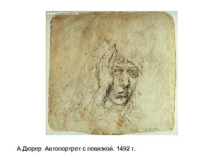 А. Дюрер Автопортрет с повязкой. 1492 г. 