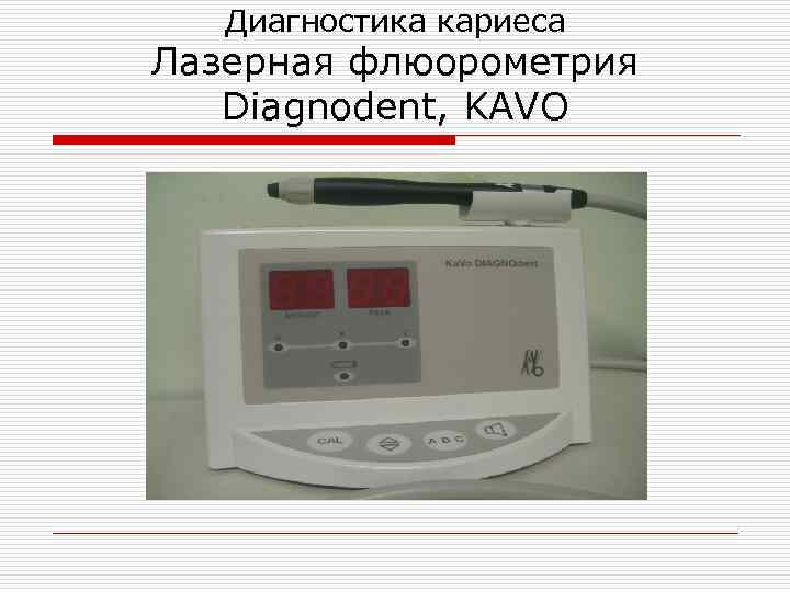 Диагностика кариеса Лазерная флюорометрия Diagnodent, KAVO 