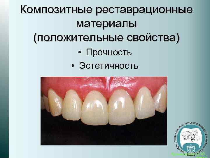 Композитные реставрационные материалы (положительные свойства) • Прочность • Эстетичность Кузьминская О. Ю. , 