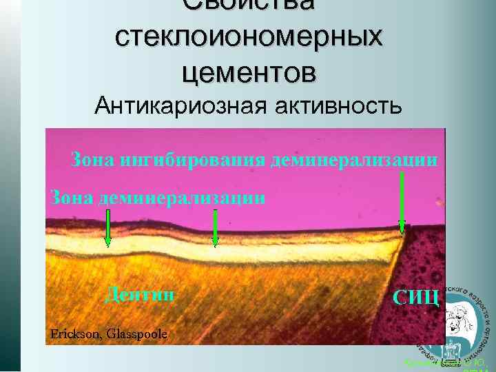 Свойства стеклоиономерных цементов Антикариозная активность Erickson, Glasspoole Кузьминская О. Ю. , 