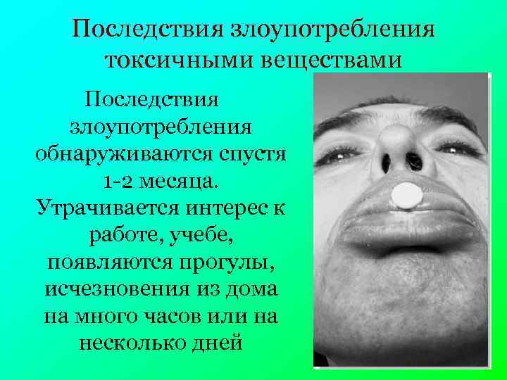 Последствия злоупотребления токсичными веществами Последствия злоупотребления обнаруживаются спустя 1 -2 месяца. Утрачивается интерес к