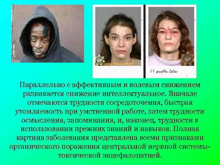 Параллельно с аффективным и волевым снижением развивается снижение интеллектуальное. Вначале отмечаются трудности сосредоточения, быстрая