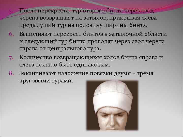 5. После перекреста, тур второго бинта через свод черепа возвращают на затылок, прикрывая слева