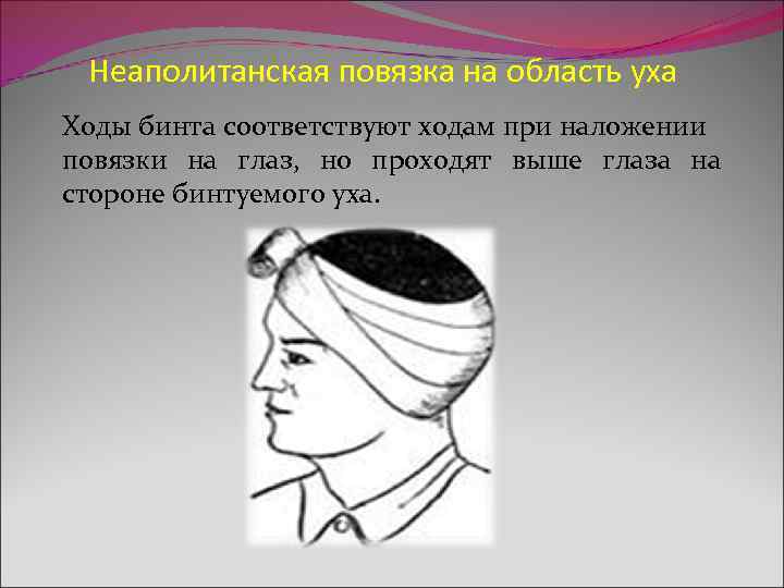  Неаполитанская повязка на область уха Ходы бинта соответствуют ходам при наложении повязки на