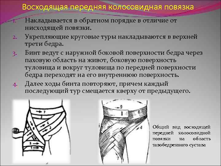  Восходящая передняя колосовидная повязка 1. Накладывается в обратном порядке в отличие от нисходящей