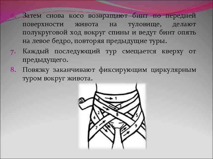 6. Затем снова косо возвращают бинт по передней поверхности живота на туловище, делают полукруговой