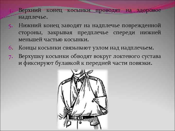 4. Верхний конец косынки проводят на здоровое надплечье. 5. Нижний конец заводят на надплечье