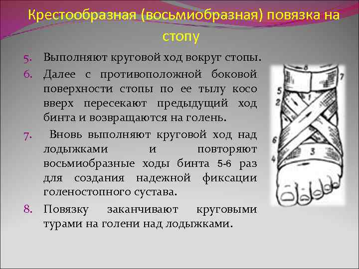 Крестообразная (восьмиобразная) повязка на стопу 5. Выполняют круговой ход вокруг стопы. 6. Далее с