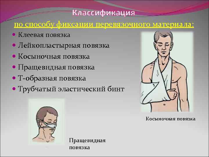  Классификация по способу фиксации перевязочного материала: Клеевая повязка Лейкопластырная повязка Косыночная повязка Пращевидная