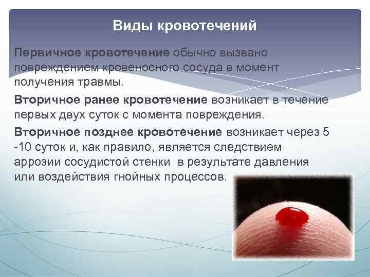 Виды кровотечений Первичное кровотечение обычно вызвано повреждением кровеносного сосуда в момент получения травмы. Вторичное