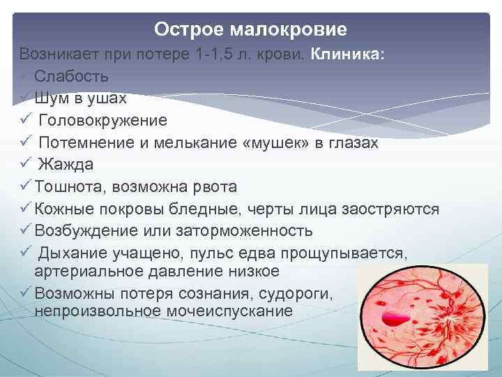Острое малокровие Возникает при потере 1 -1, 5 л. крови. Клиника: ü Слабость ü